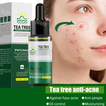 Tea Tree Acne Removal Serum Repair Acne Serum Oil.