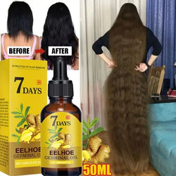 Fast Hair Growth Oil - Ginger Treatment.