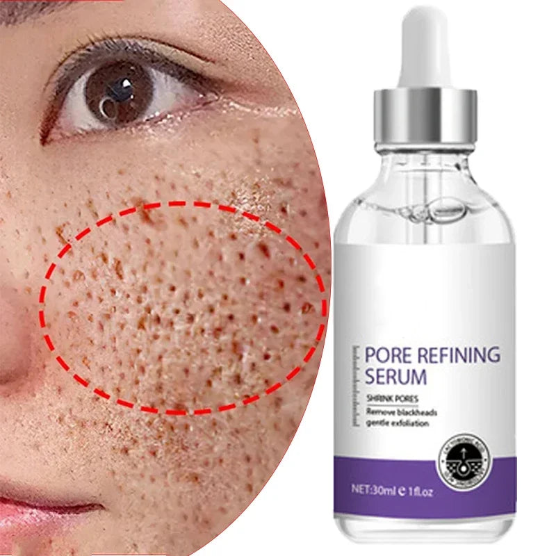 Skin Texture | Pore Refining Resurfacing, Brightening Facial Serum .