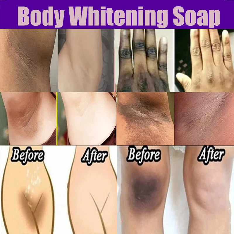 Body Whitening Soap Deep Clean Skin.