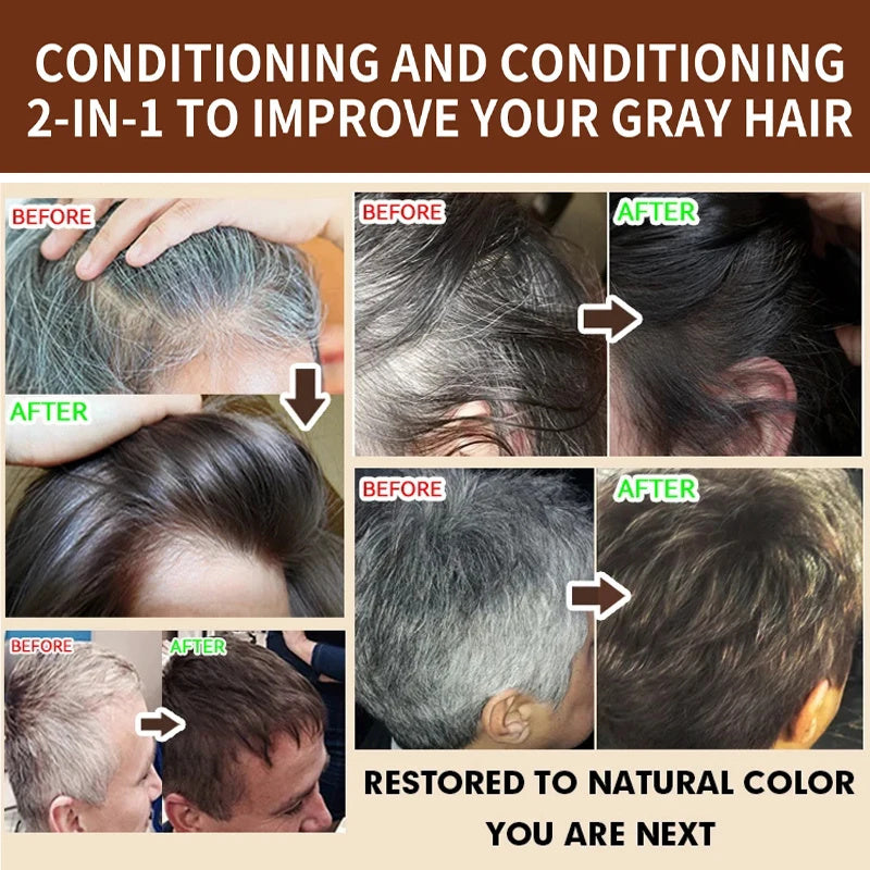 Gray White Hair Treatment Shampoo White To Black Natural Color.