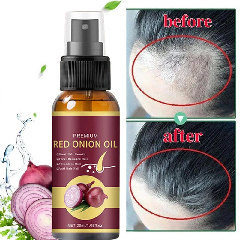 **Powerful Hair Growth Serum Spray - Regrowth.