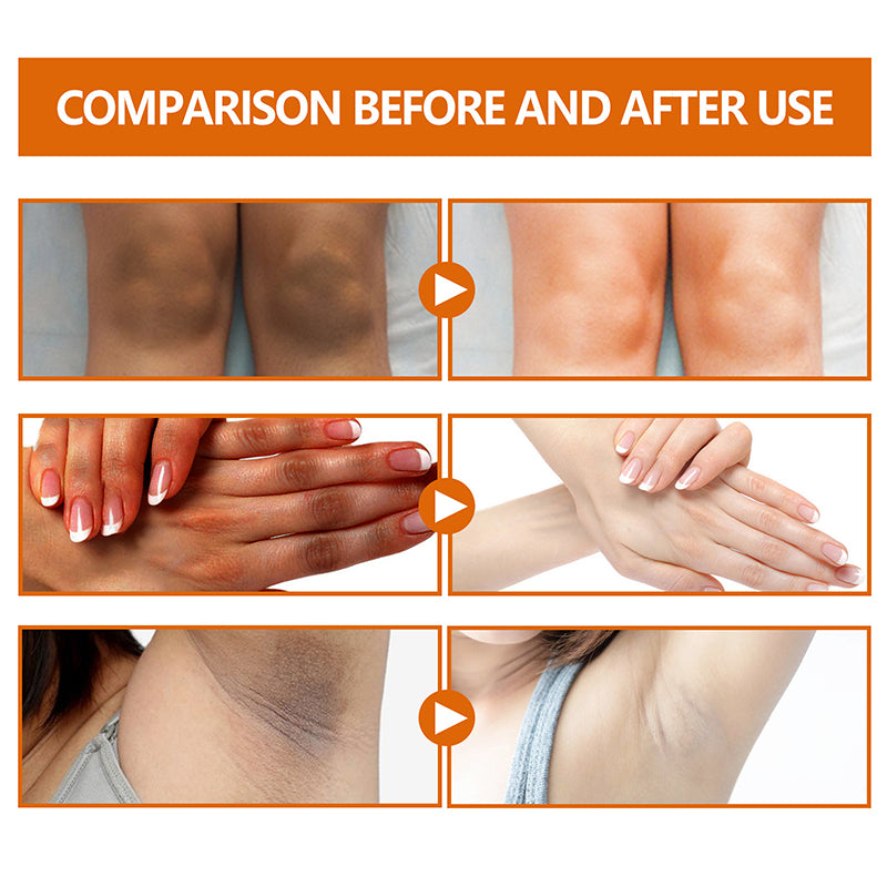 Body Whitening Lotion for Women - Dark Skin.