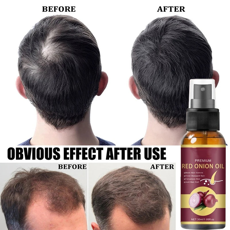 **Powerful Hair Growth Serum Spray - Regrowth.