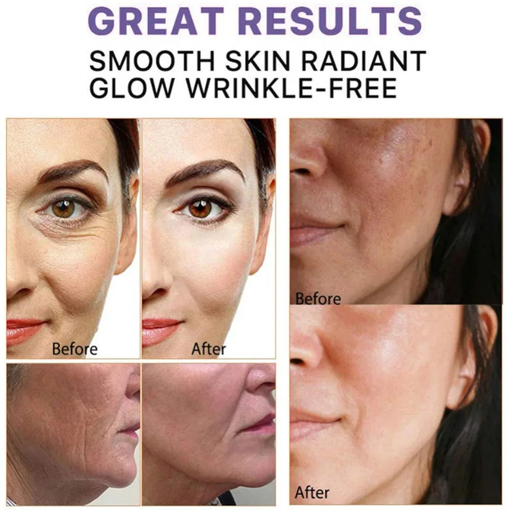 New Remove Wrinkle Face Cream Improve Puffiness.