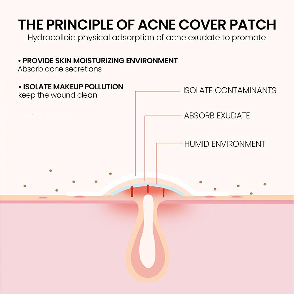 200pcs Invisible Acne Pimple Repair Patches.