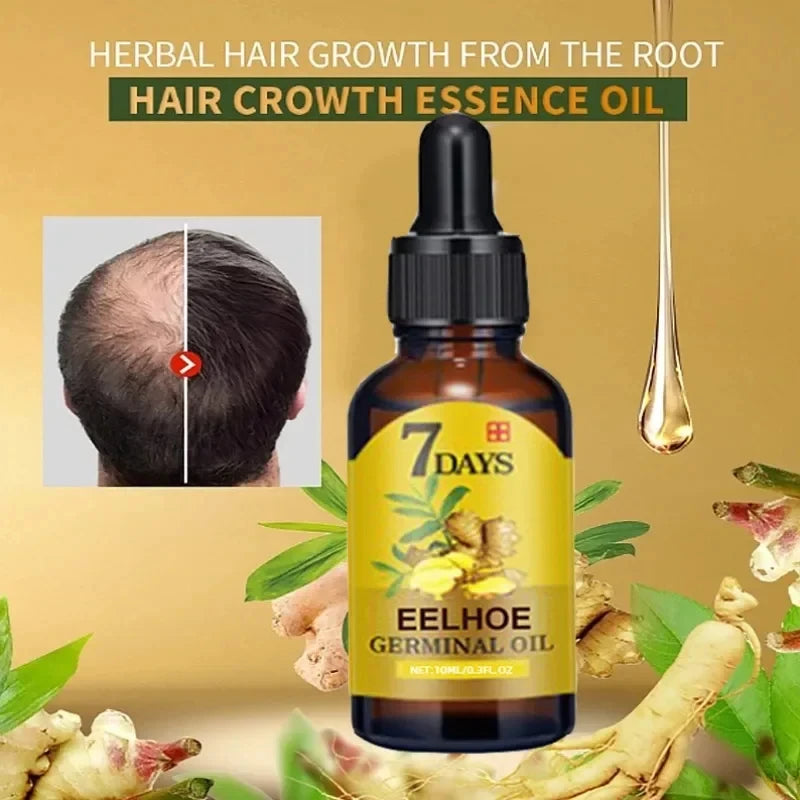 Fast Hair Growth Oil - Ginger Treatment.