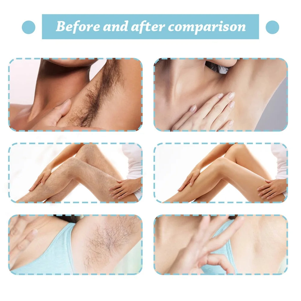 20ml Permanent Hair Removal Spray Painless Legs Arm Hair.