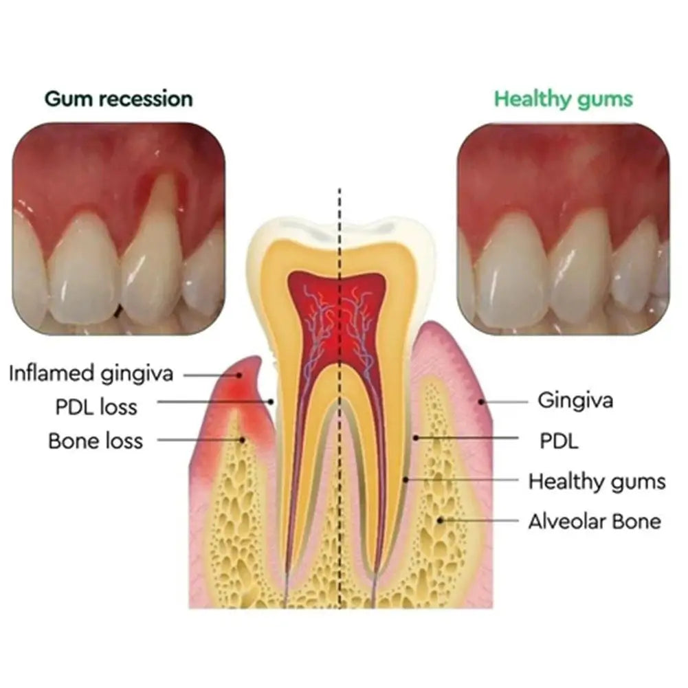 30ml Quickly Repair Cavities Caries Mousse.