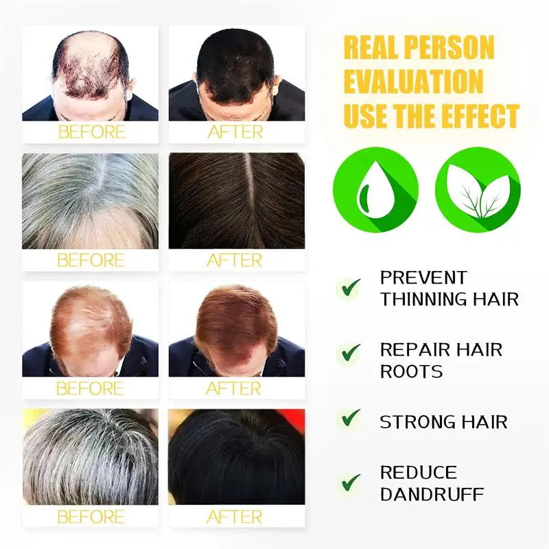 Gray White Hair Treatment Shampoo White To Black Natural Color.