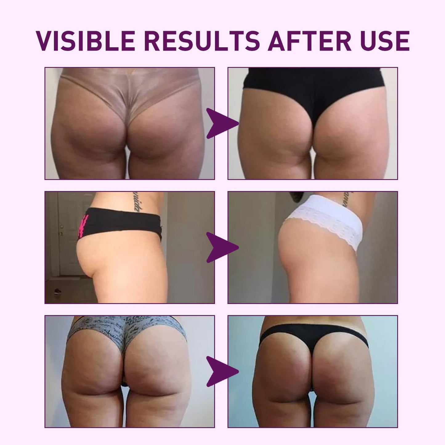 Hip Buttock Enlargement Cream Effective Lifting.