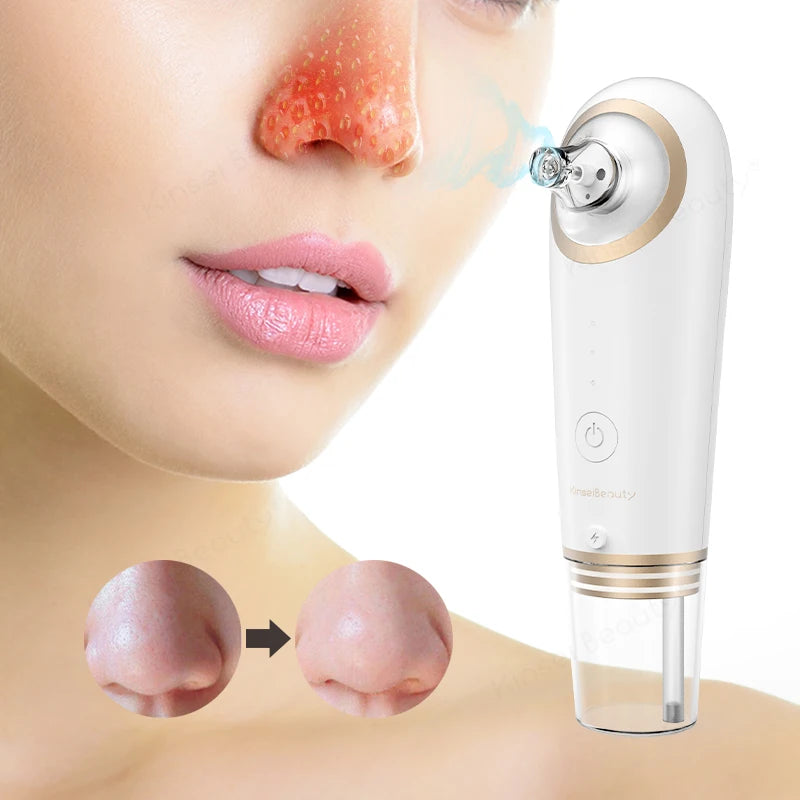 Electric Face Cleaner Blackhead Remover.