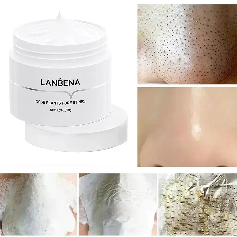 LANBENA Blackhead Remover Cream Paper Plant Pore Strips Nose Acne Cleansing Black Dots Peel Off Mud Mask Treatments Skin Care