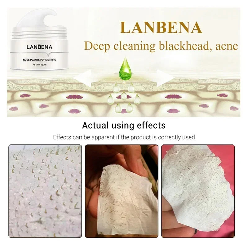 LANBENA Blackhead Remover Cream Paper Plant Pore Strips Nose Acne Cleansing Black Dots Peel Off Mud Mask Treatments Skin Care