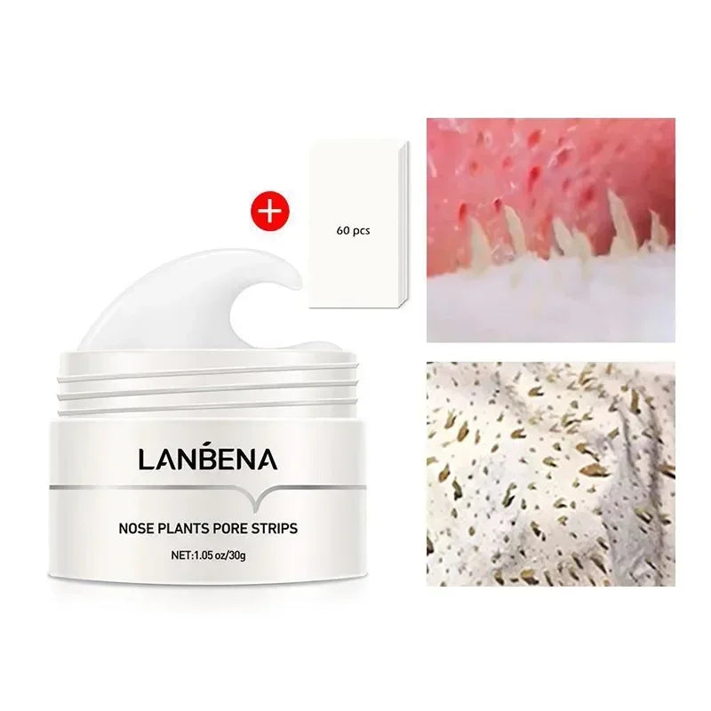 LANBENA Blackhead Remover Cream Paper Plant Pore Strips Nose Acne Cleansing Black Dots Peel Off Mud Mask Treatments Skin Care