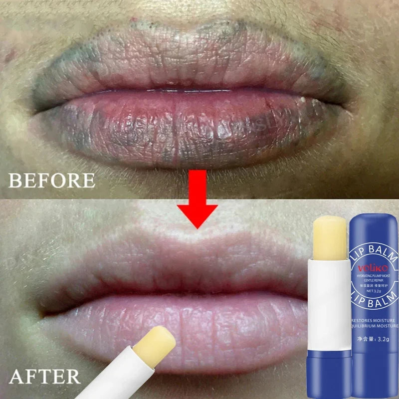 Lip Balm Remove Dark Lighten Melanin Lip Mask Brighten Exfoliating Fade Lip Line Moisturize Dead Skin Repair Lip Care New