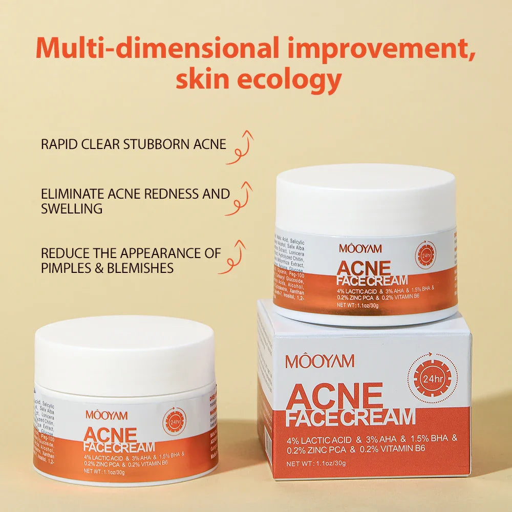 Transform Your Skin with Maigoole Acne Treatment Cream