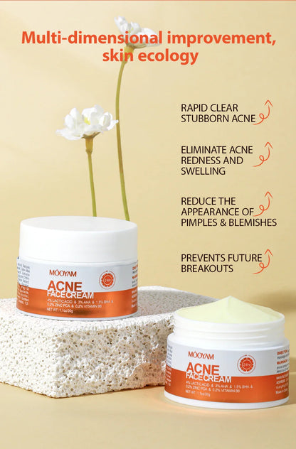 Transform Your Skin with Maigoole Acne Treatment Cream