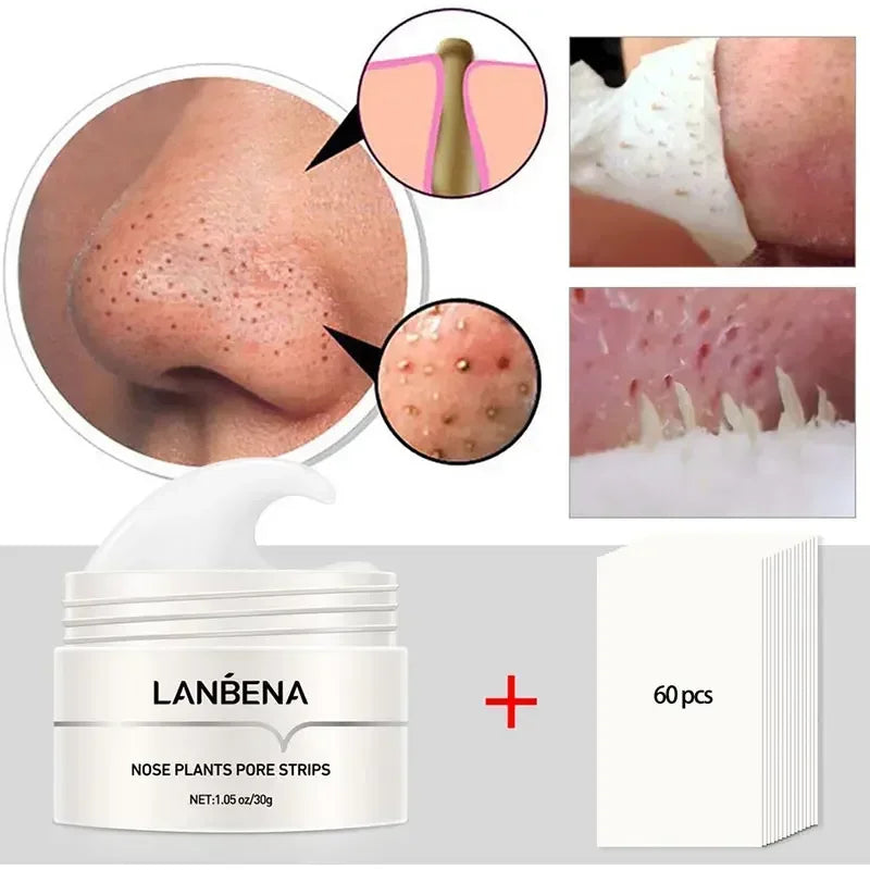 LANBENA Blackhead Remover Cream Paper Plant Pore Strips Nose Acne Cleansing Black Dots Peel Off Mud Mask Treatments Skin Care