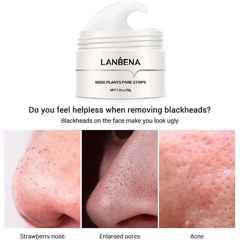 LANBENA Blackhead Remover Cream Paper Plant Pore Strips Nose Acne Cleansing Black Dots Peel Off Mud Mask Treatments Skin Care