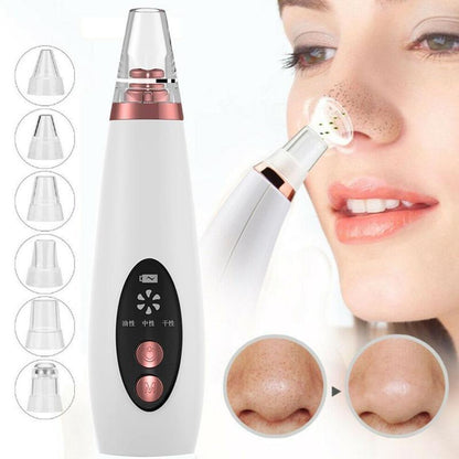 Blackhead Pore Vacuum Cleaner Nose